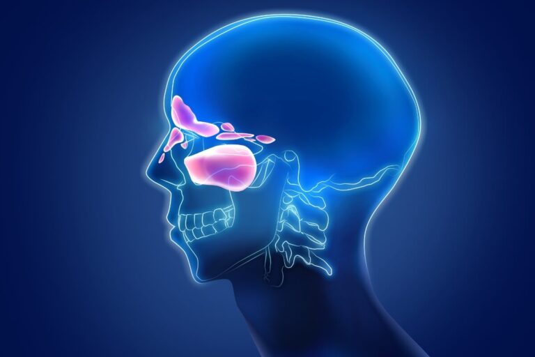 Can Swimming Cause Headaches? The Head Above Water Connection Between