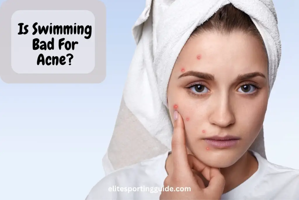 is swimming bad for acne