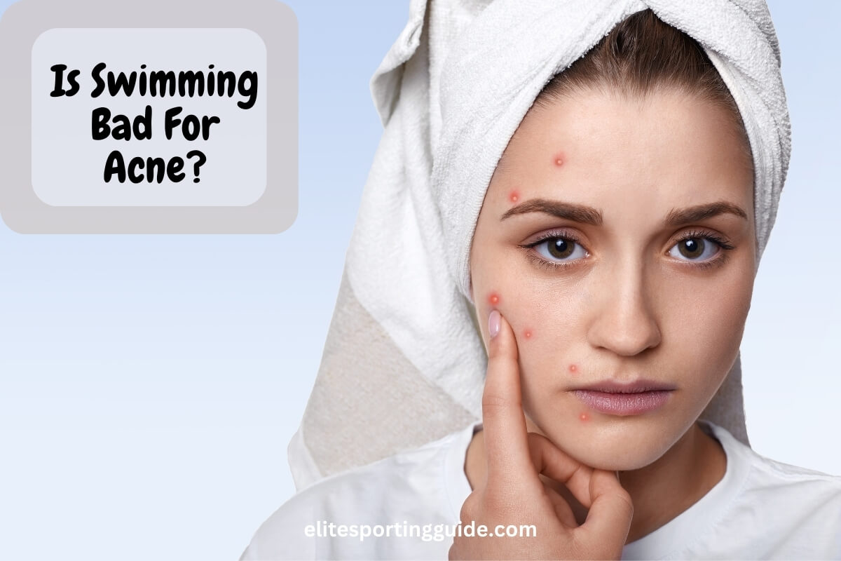 Is Swimming Bad For Acne? Taking A Skin Deep Dive Elite Sporting Guide